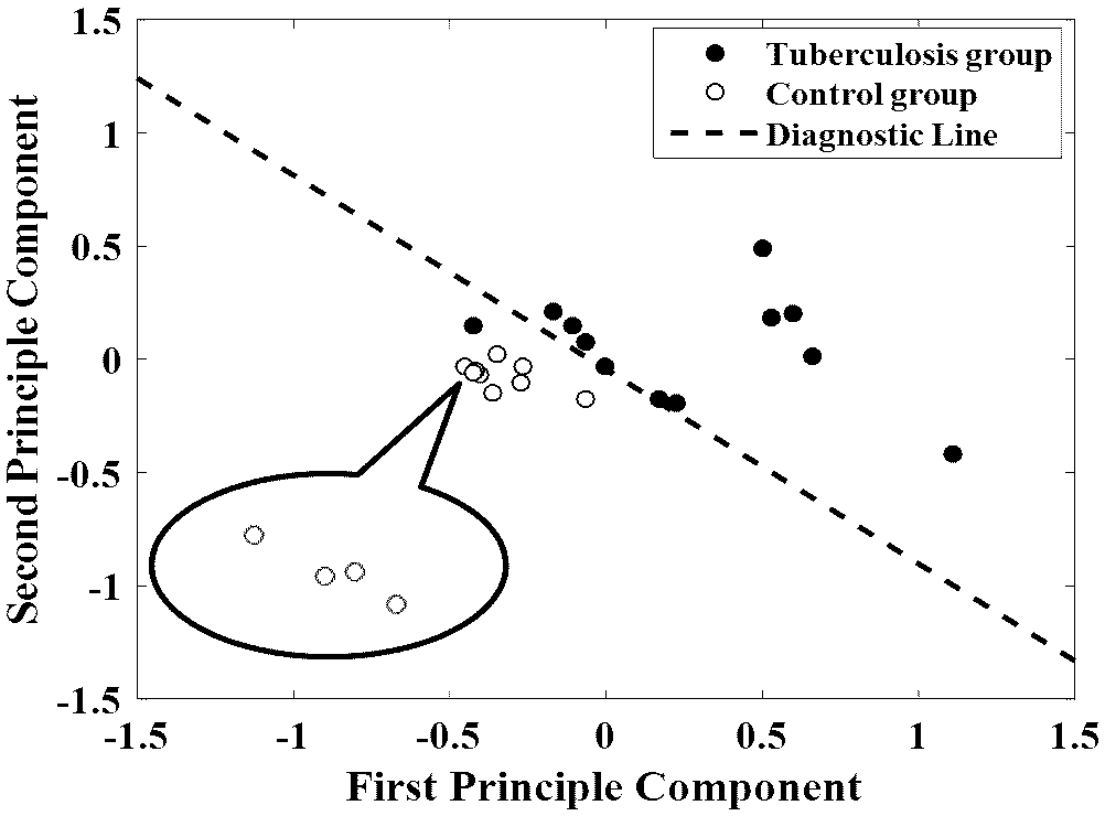 Method for detecting pulmonary tuberculosis diseases based on human plasma autofluorescence spectra