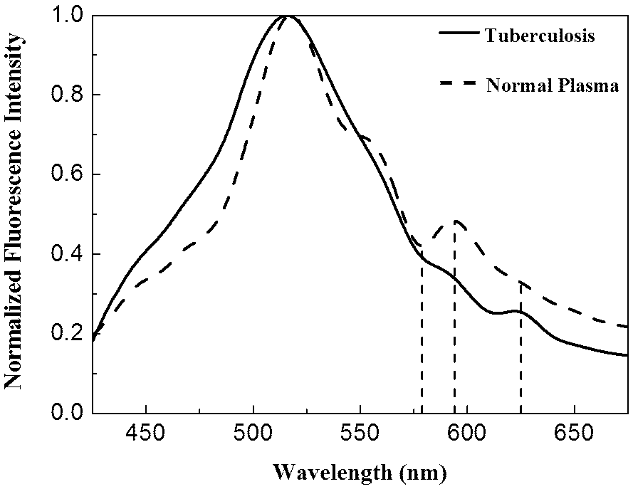 Method for detecting pulmonary tuberculosis diseases based on human plasma autofluorescence spectra