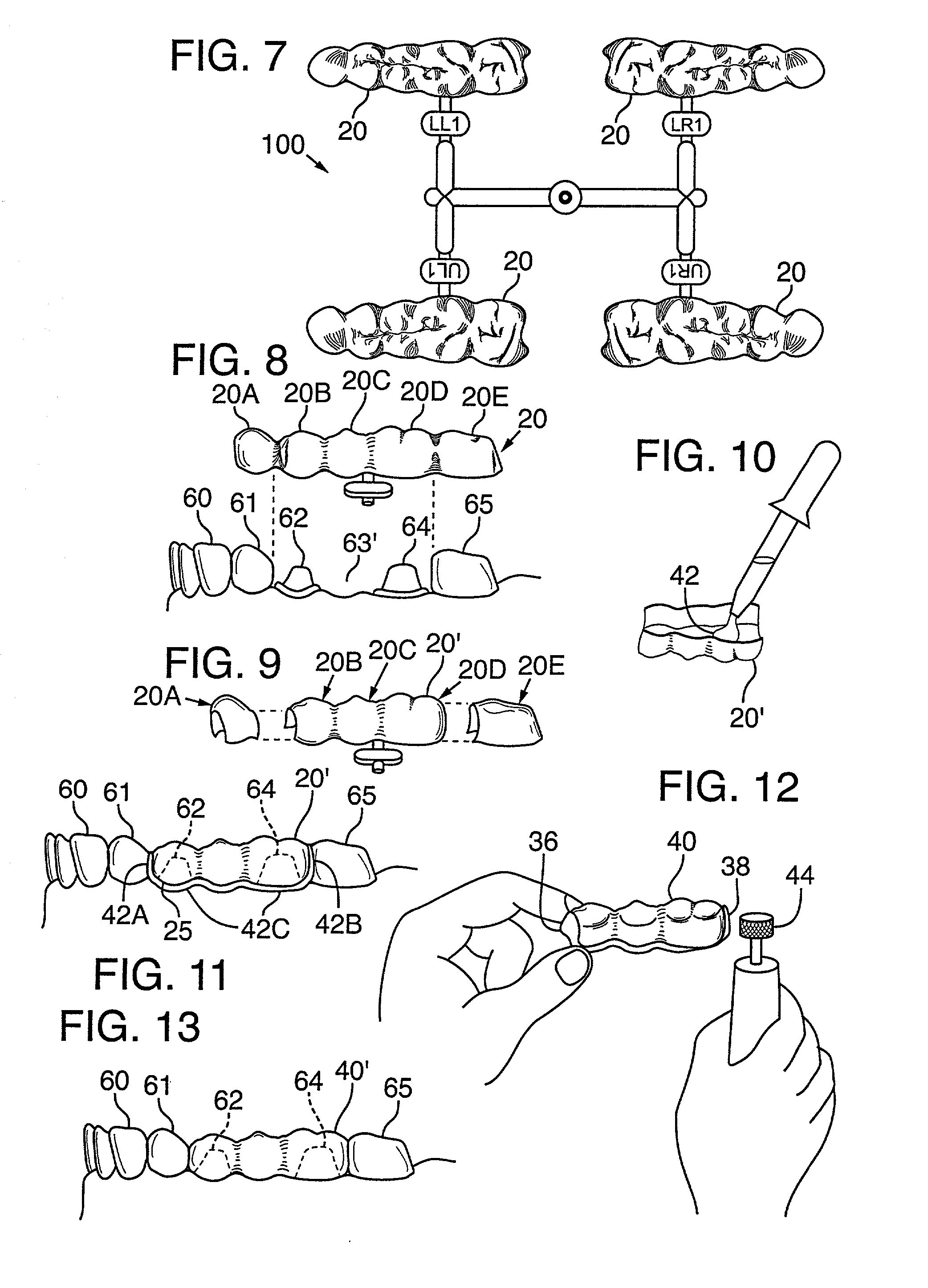 Quadrant and anterior dental shells and method of making a multi-tooth crown or bridge