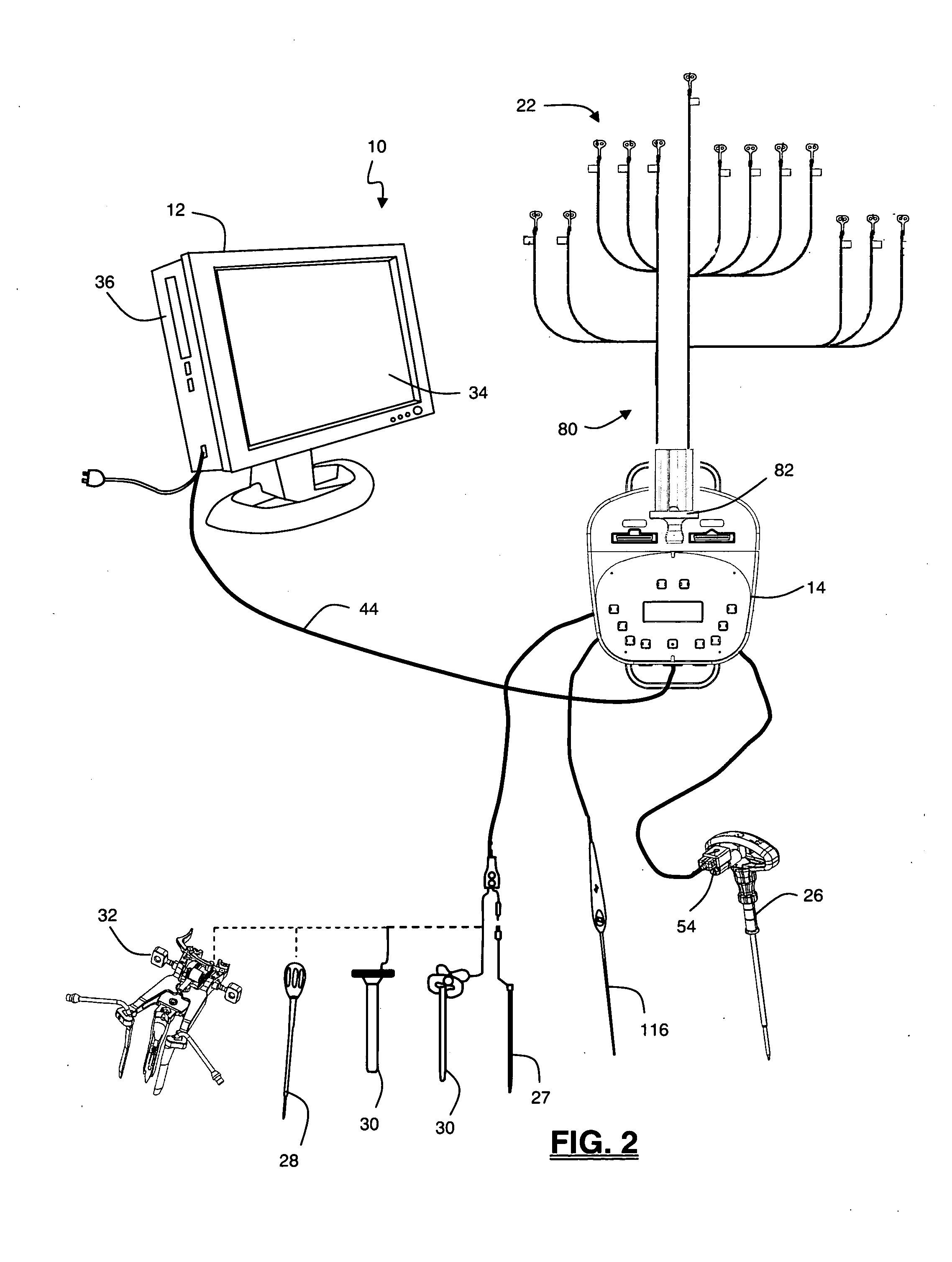 Neurophysiologic Monitoring System and Related Methods