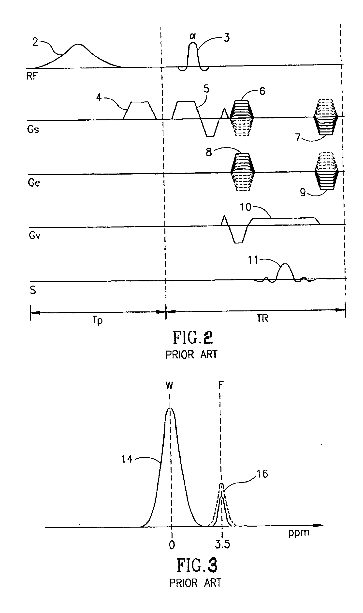 Magnetic resonance image acquisition with suppression of background tissues and RF water excitation at offset frequency