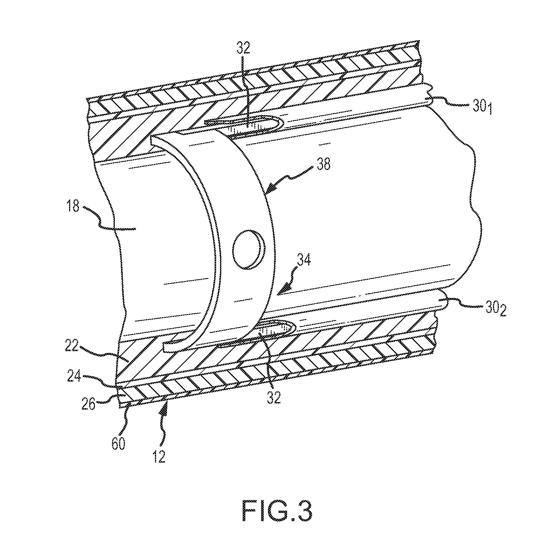 Deflectable medical devices and methods of manufacturing therefor