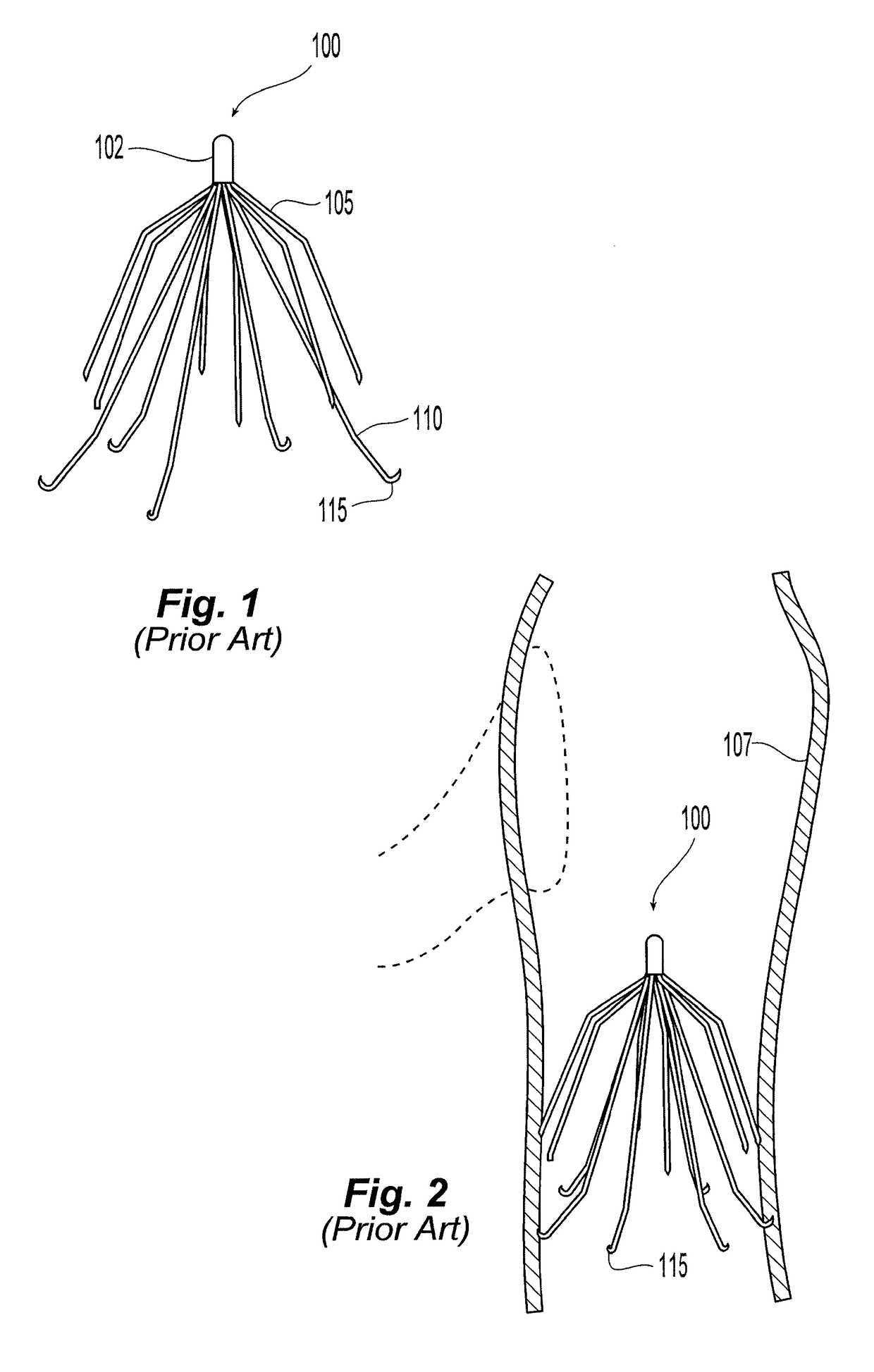 Inferior vena cava filter with stability features