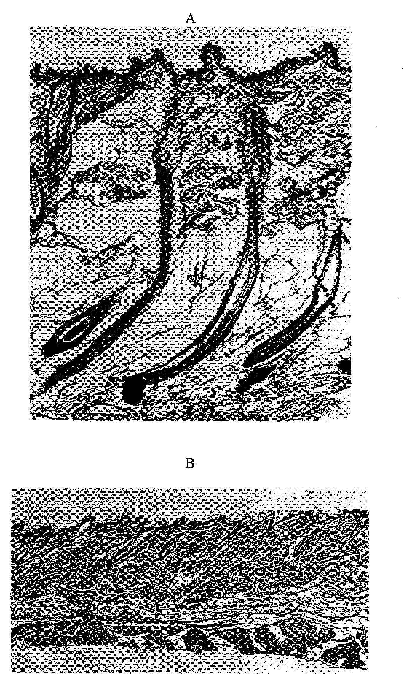 Extracellular matrix compositions