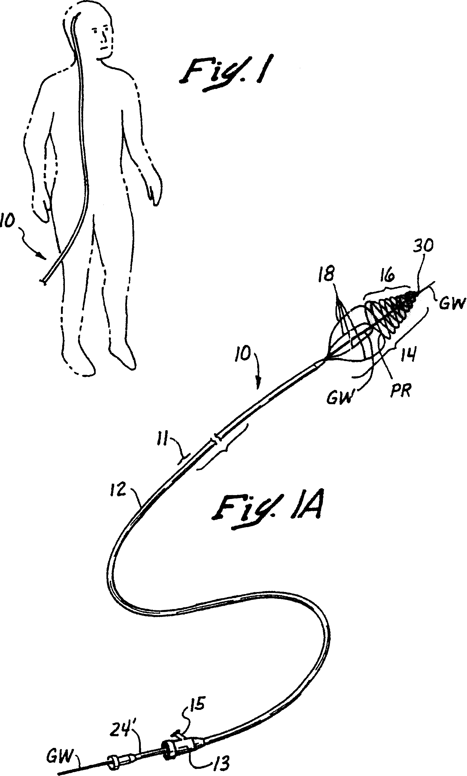 Embolectomy catheters and method for treatment