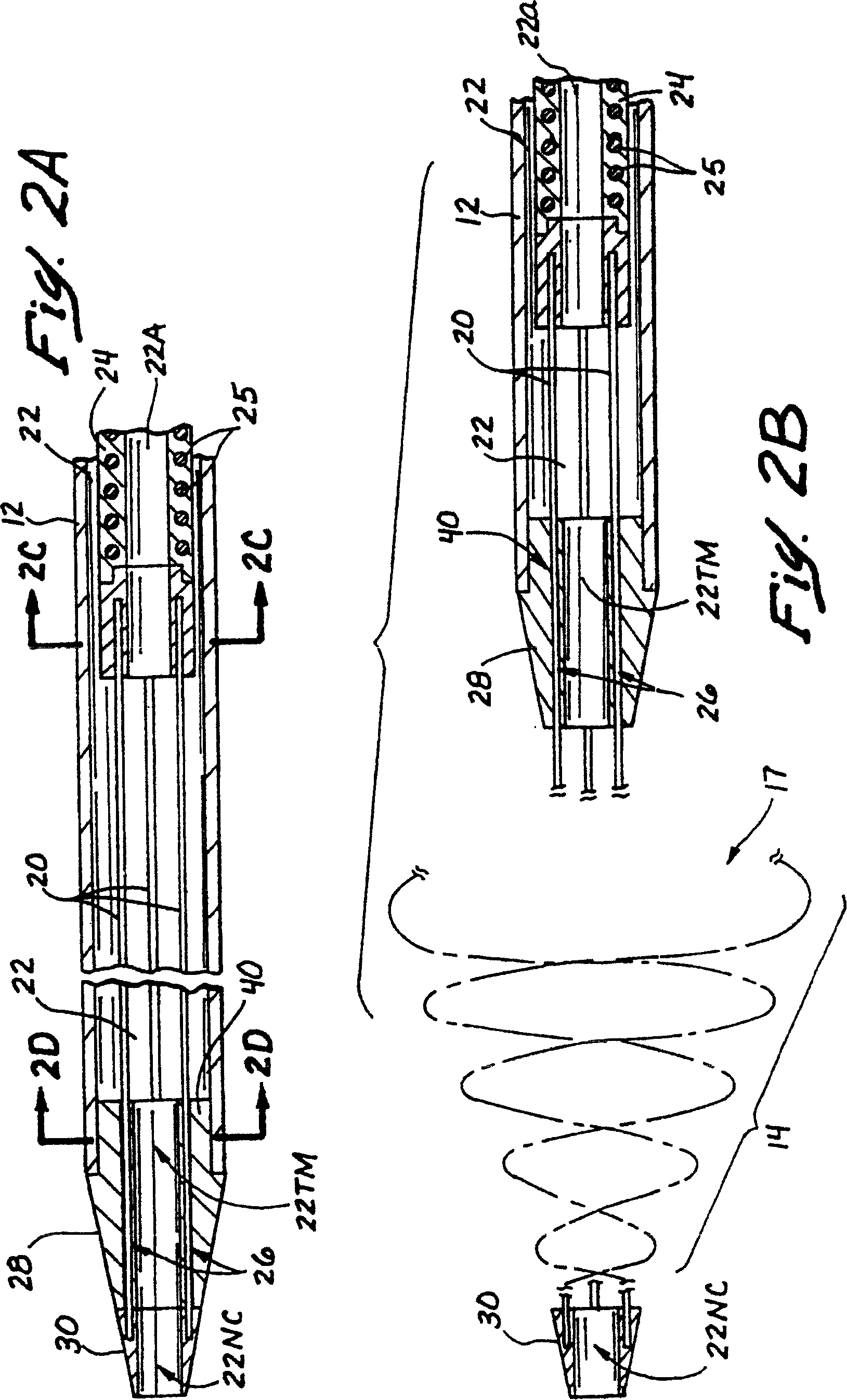 Embolectomy catheters and method for treatment