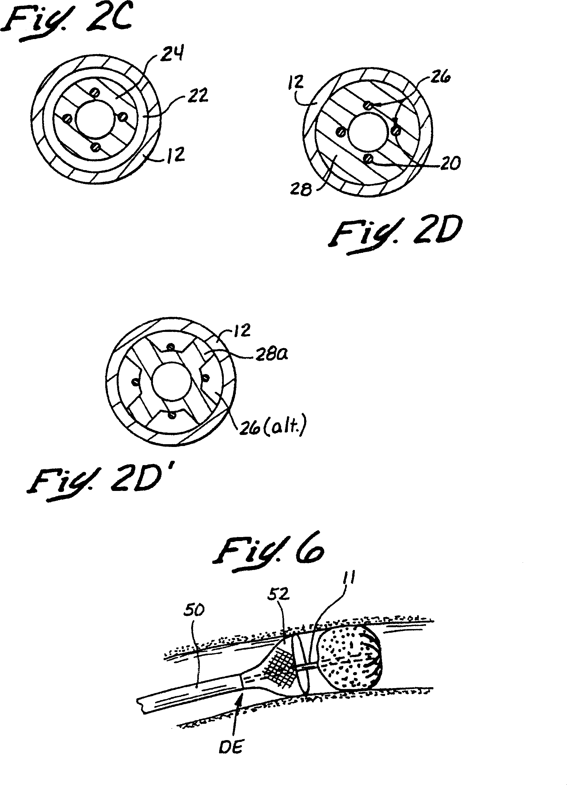 Embolectomy catheters and method for treatment