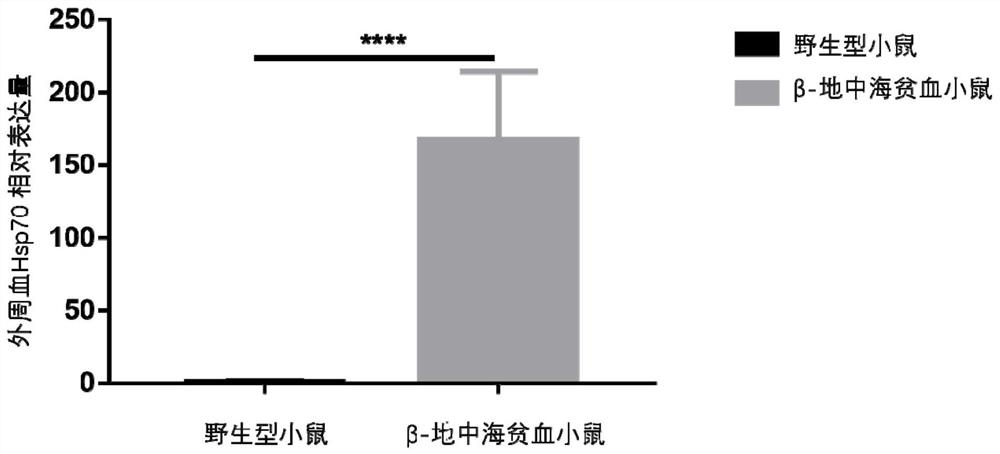 Application of HSP70 as molecular marker to detection of thalassemia and preparation of diagnostic kit