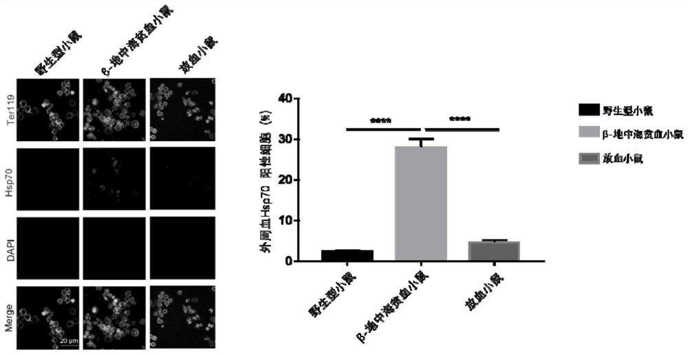 Application of HSP70 as molecular marker to detection of thalassemia and preparation of diagnostic kit