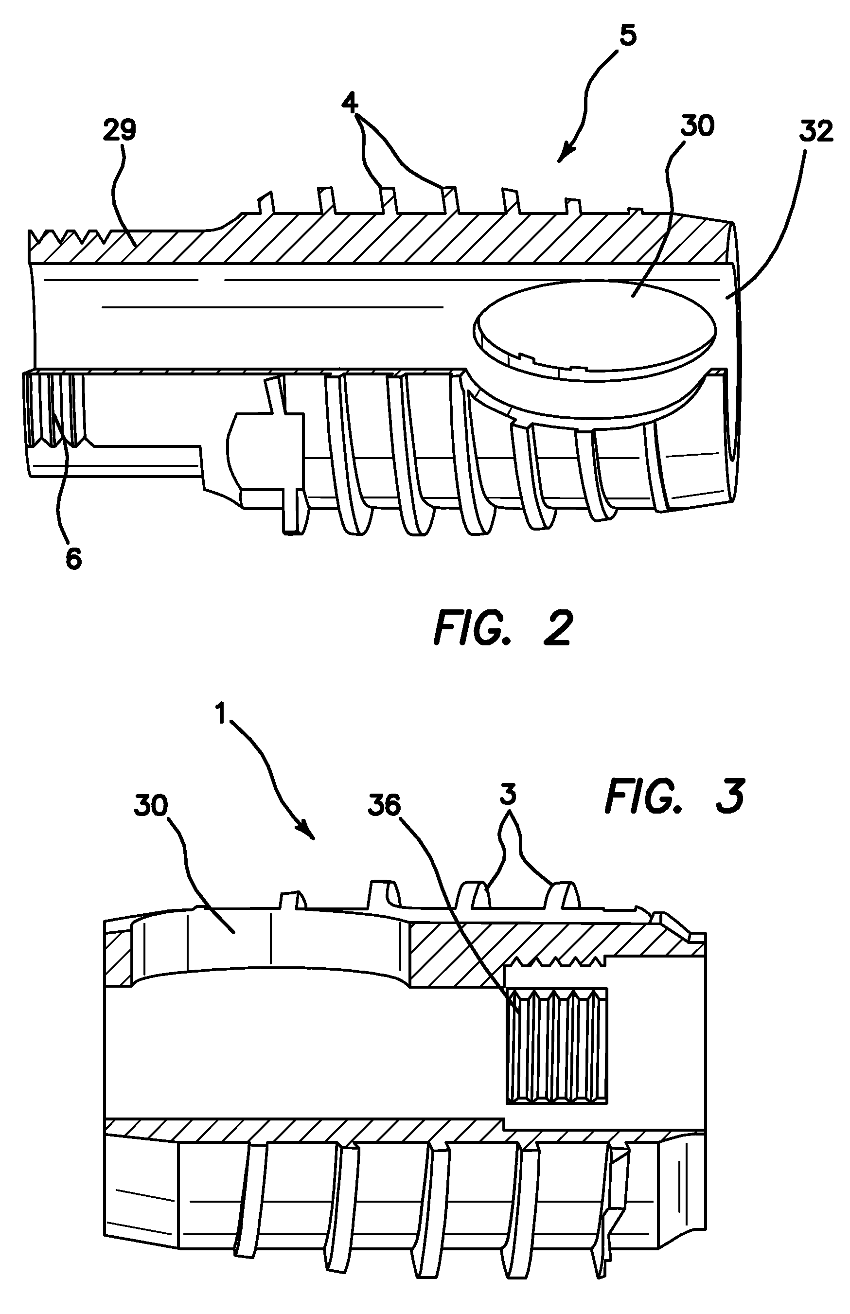 Apparatus and Method for Use in the Treatment of Hammertoe