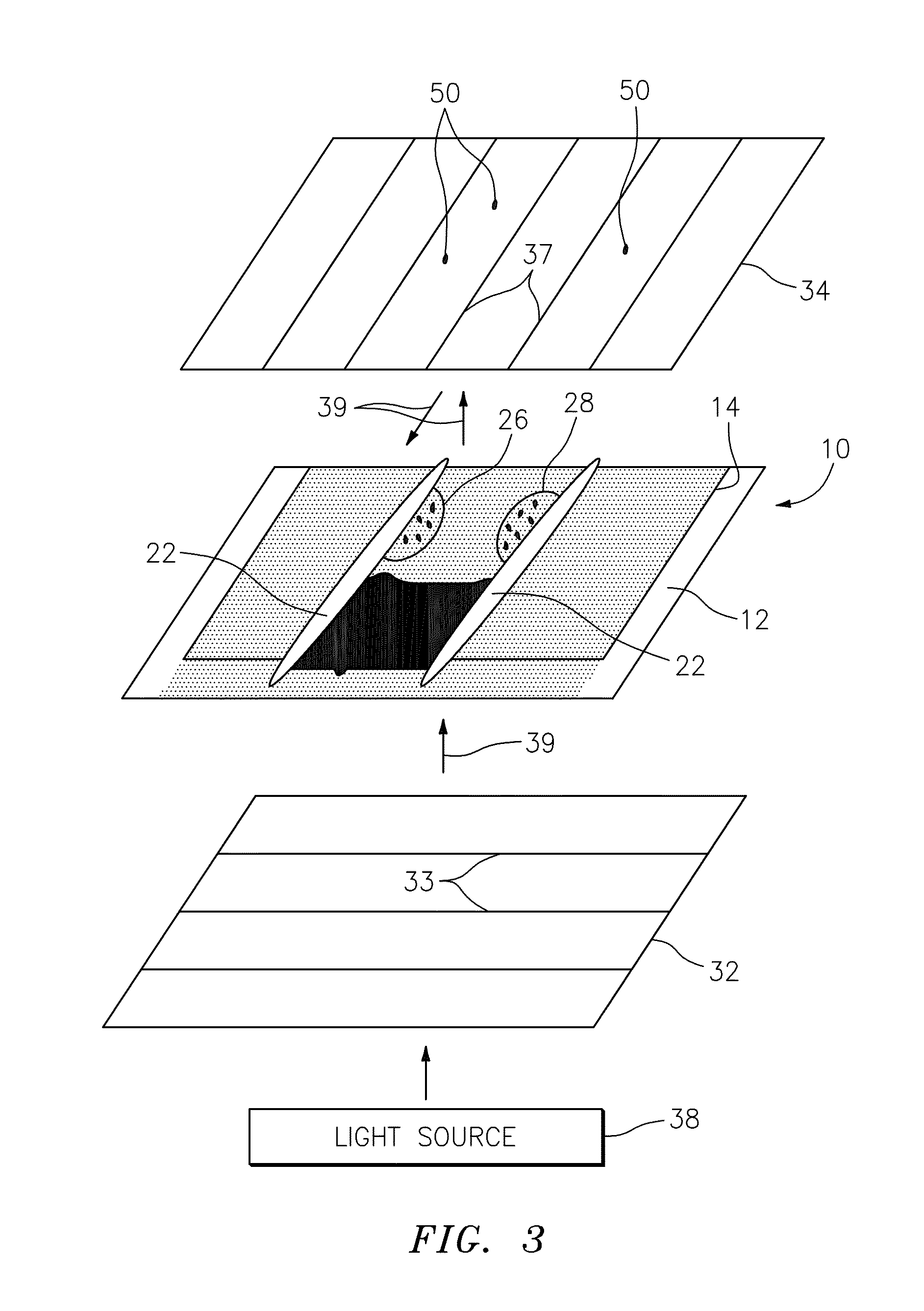 Method for detecting the presence of anisotropic crystals in undiluted whole blood