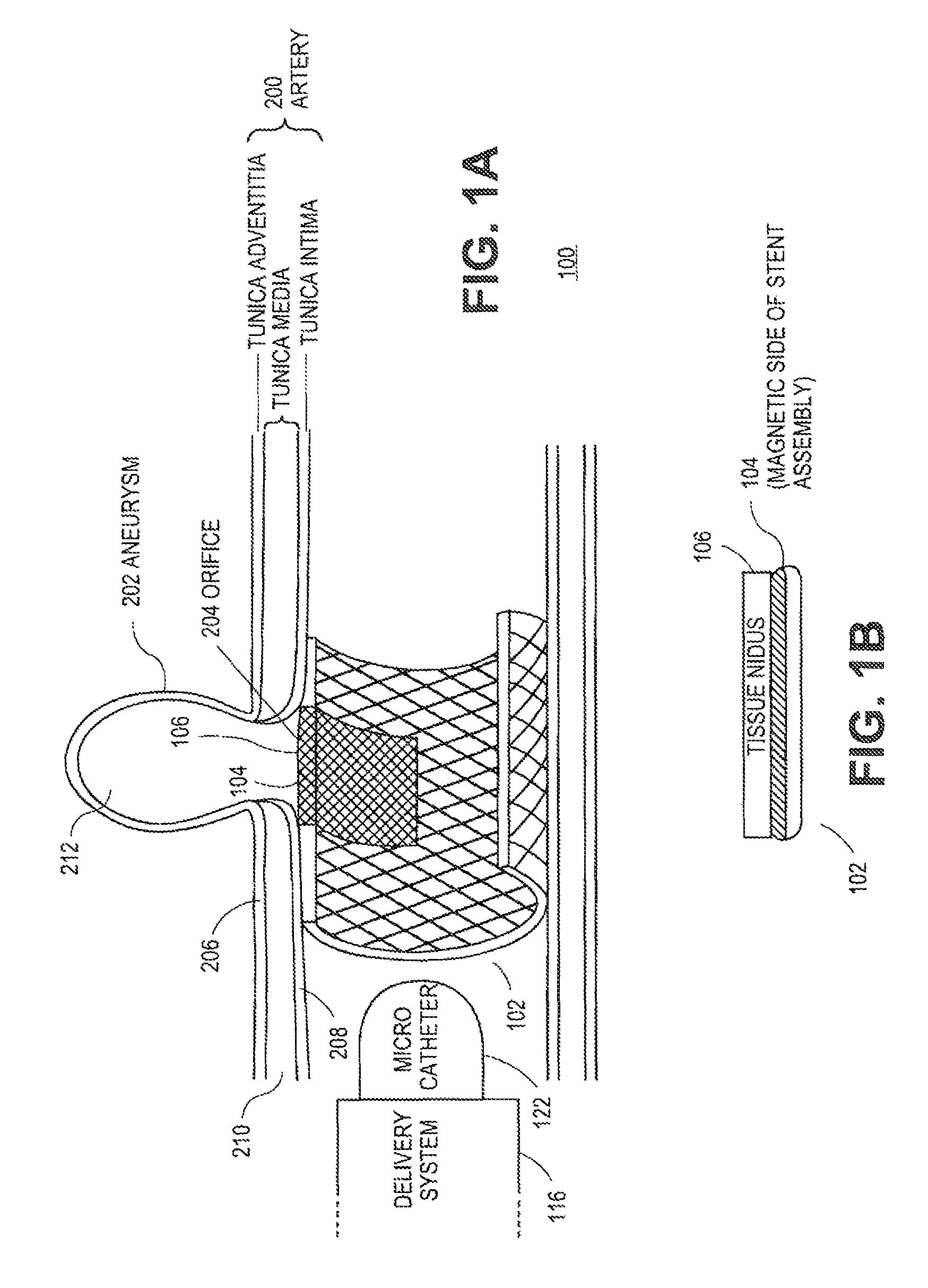 Systems and methods for magnetized stent having growth-promoting properties