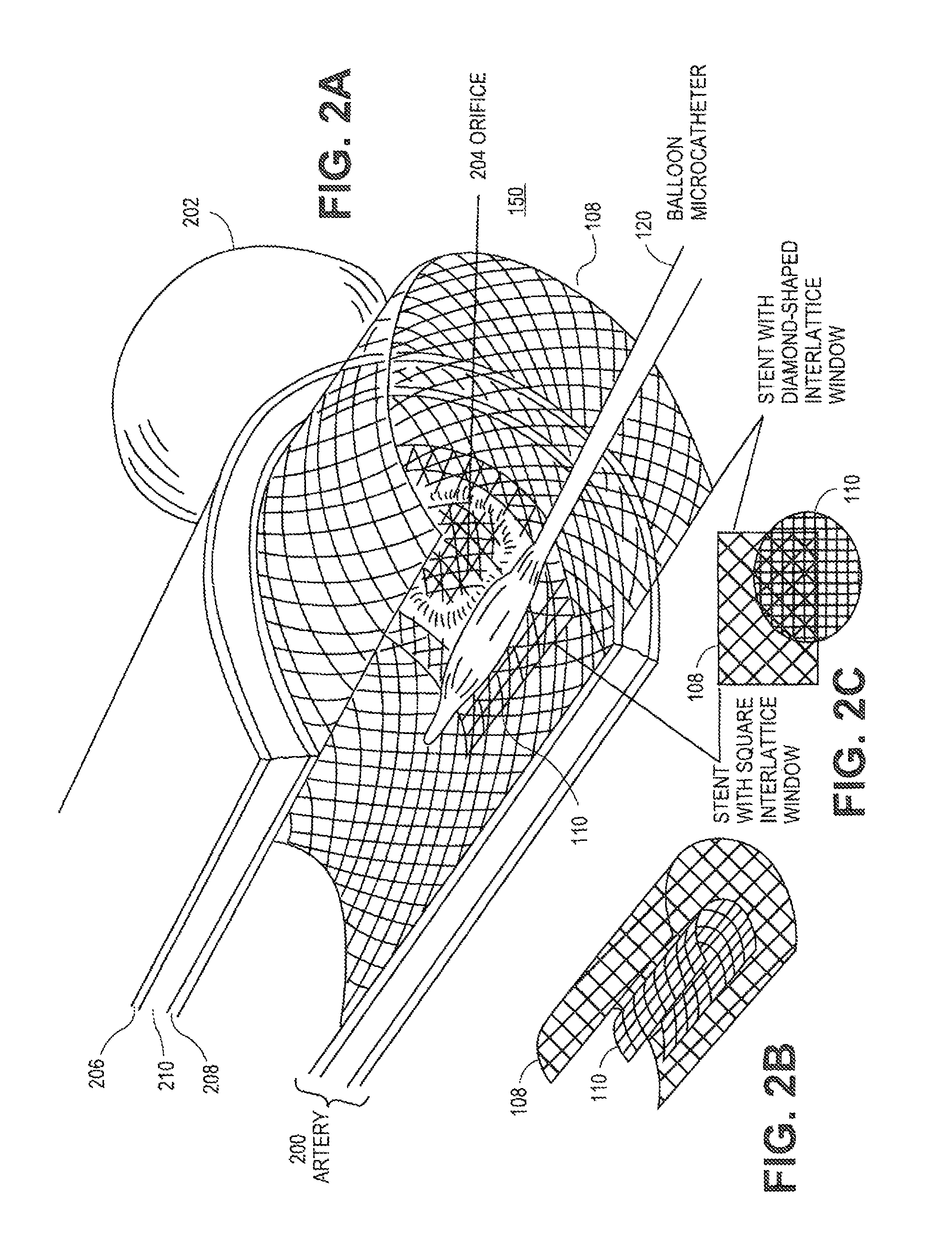 Systems and methods for magnetized stent having growth-promoting properties