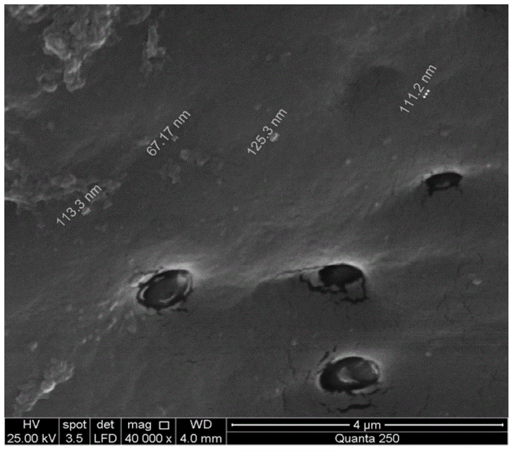 Preparation method for microvesicle composite regenerative medical material