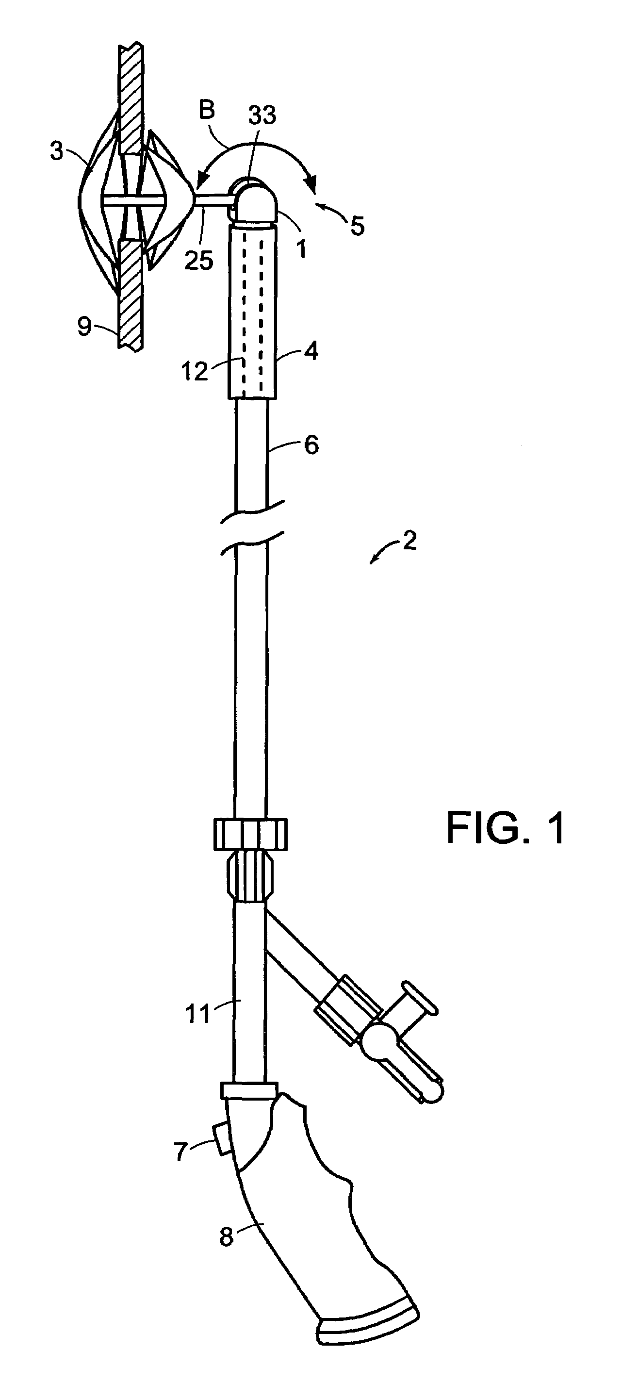 Coupling system useful in placement of implants