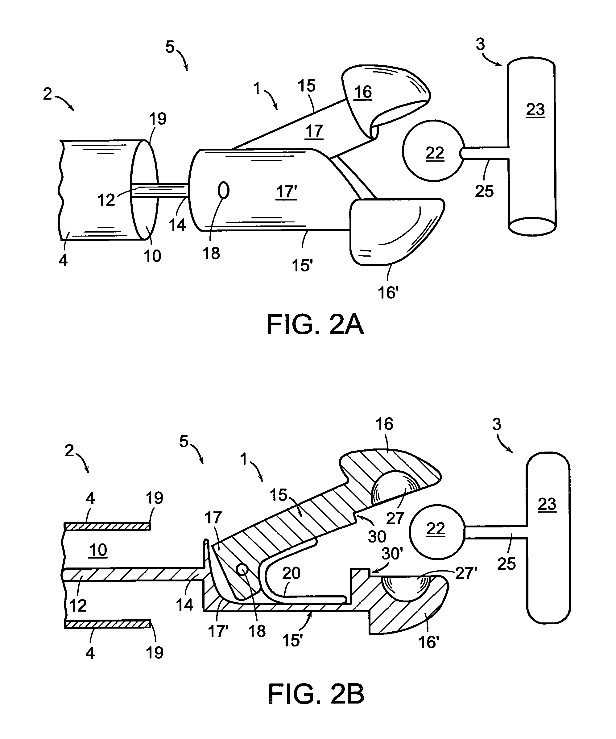 Coupling system useful in placement of implants