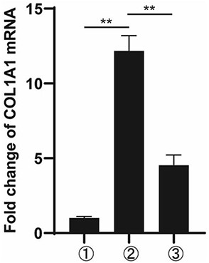 Application of Phthalazine Derivatives in Treating Hepatic Fibrosis