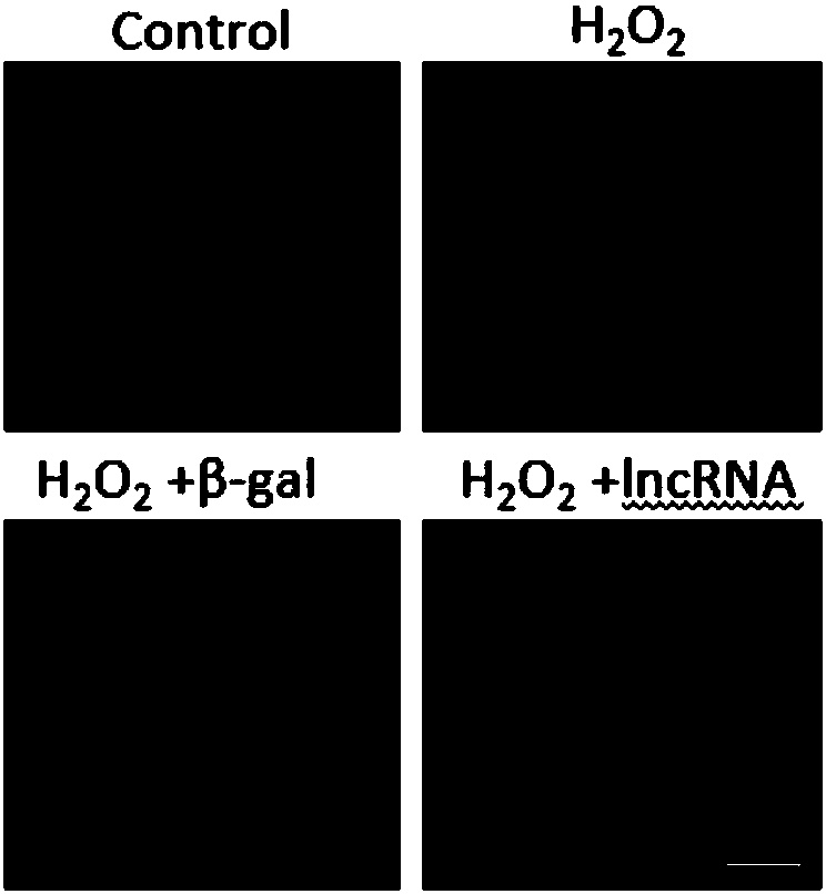 Application of LncRNA (long non-coding RNA) and medicine using same