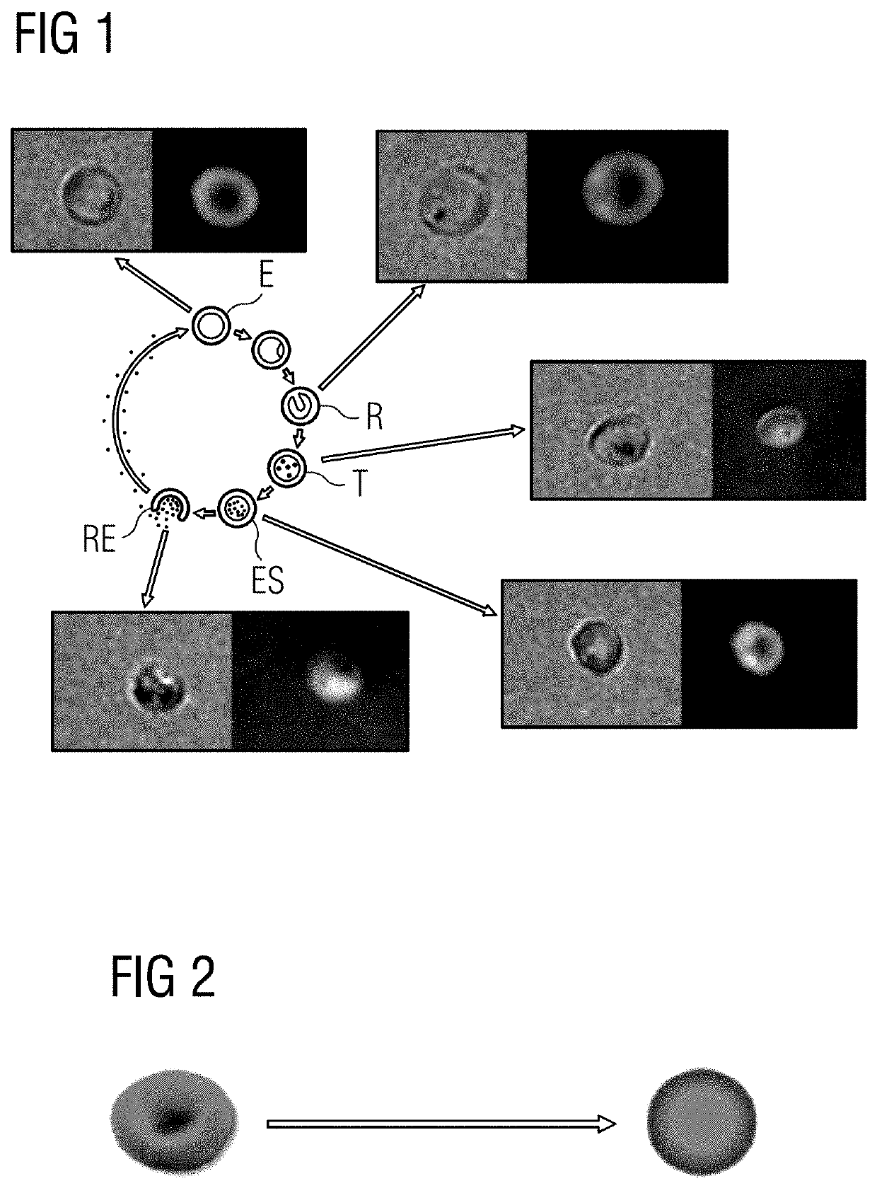 Specific malaria detection with digital holographic microscopy