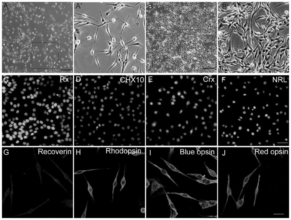A method for inducing the differentiation of human amniotic epithelial cells into retinal photoreceptor cells and its application