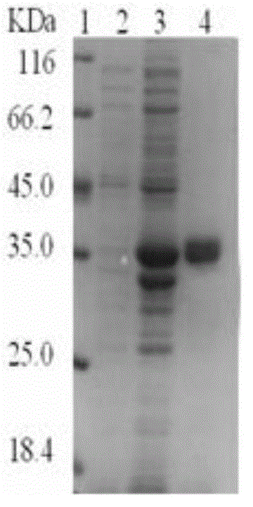 Recombinant protein of mycobacterium tuberculosis Rv 3120, preparation method and application in cellular immunological diagnosis thereof