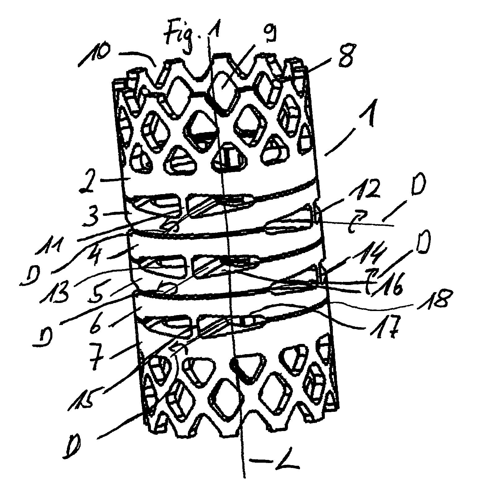 Implant with one piece swivel joint