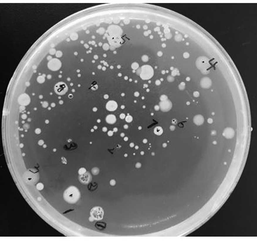 A Strain of Anaerobic Bacillus spp. and Its Application
