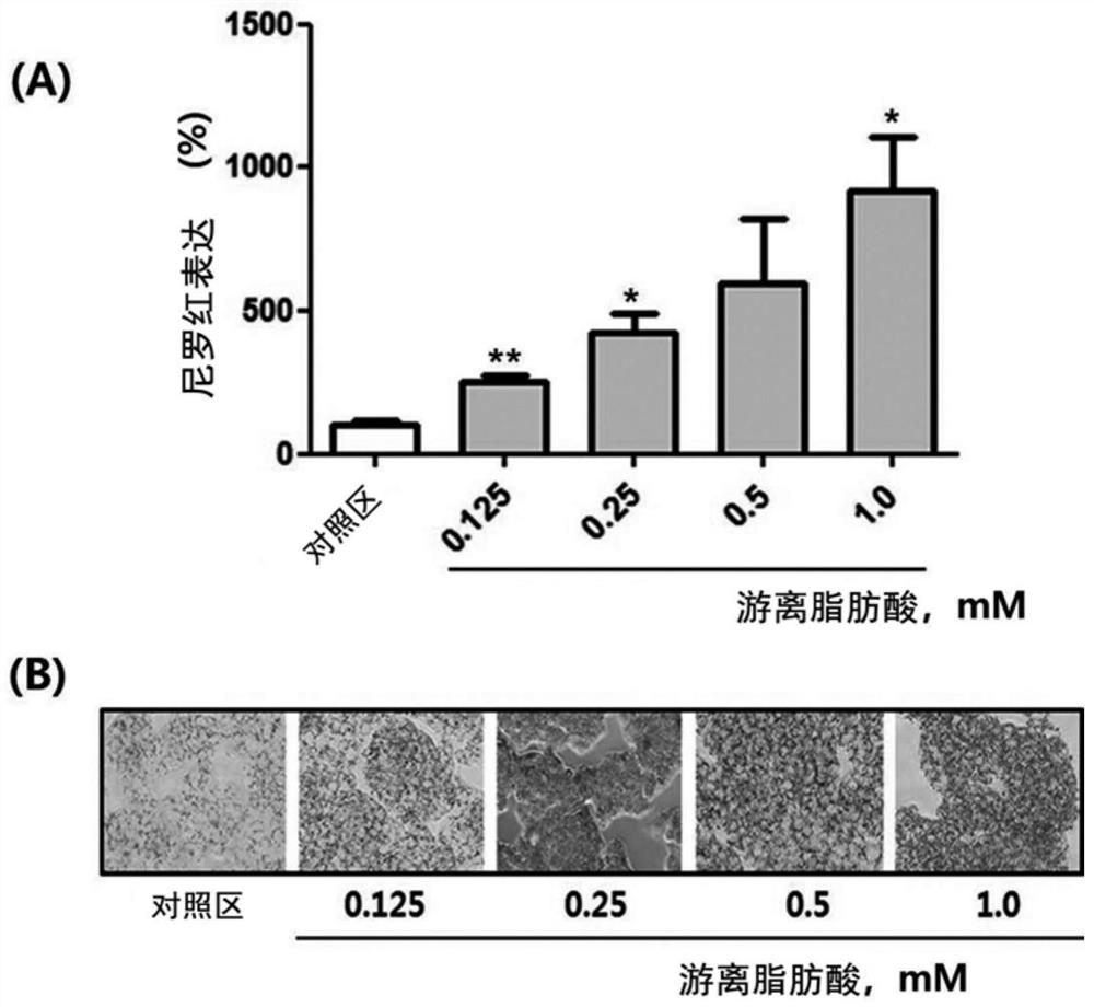 Composition for preventing or improving non-alcoholic fatty liver disease containing white lentil extract as an active ingredient