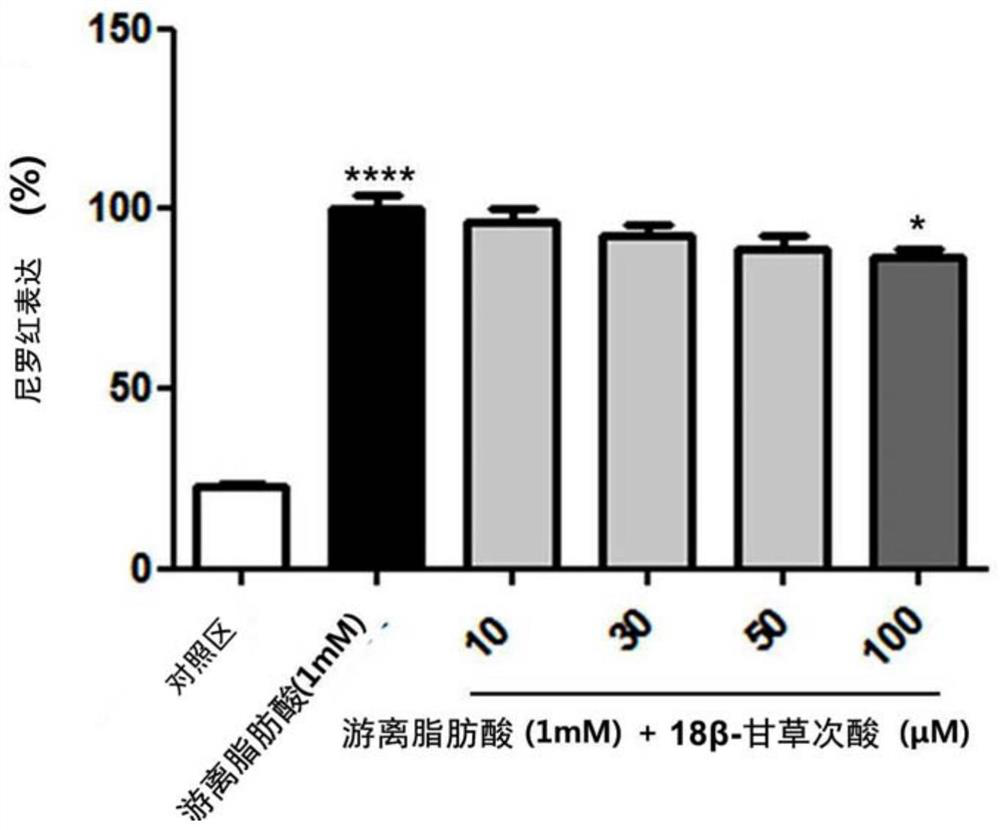 Composition for preventing or improving non-alcoholic fatty liver disease containing white lentil extract as an active ingredient