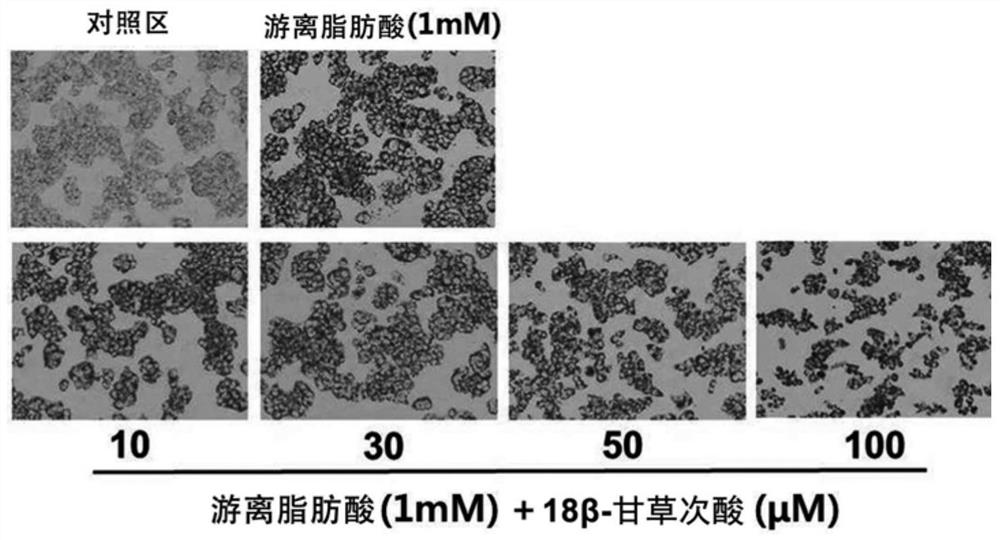 Composition for preventing or improving non-alcoholic fatty liver disease containing white lentil extract as an active ingredient