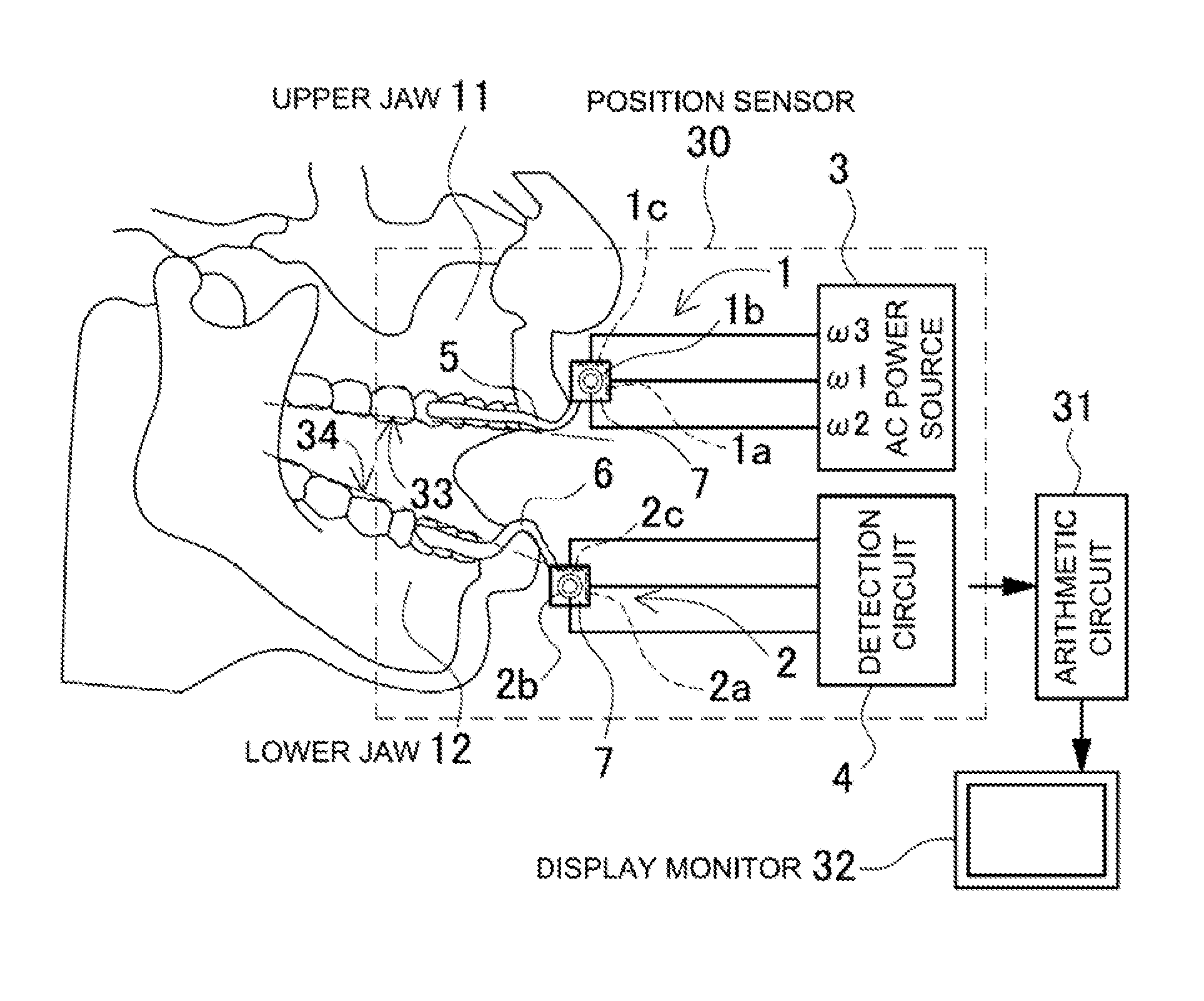 Apparatus for measuring dental occlusion