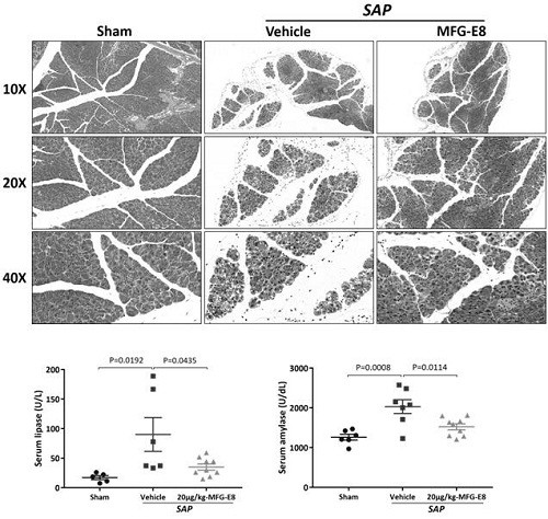 Application of human milk fat globule epidermal growth factor 8 in the preparation of drugs for the prevention/treatment of severe acute pancreatitis