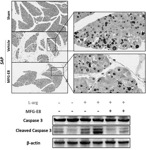 Application of human milk fat globule epidermal growth factor 8 in the preparation of drugs for the prevention/treatment of severe acute pancreatitis