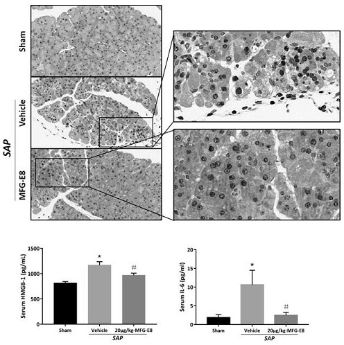 Application of human milk fat globule epidermal growth factor 8 in the preparation of drugs for the prevention/treatment of severe acute pancreatitis