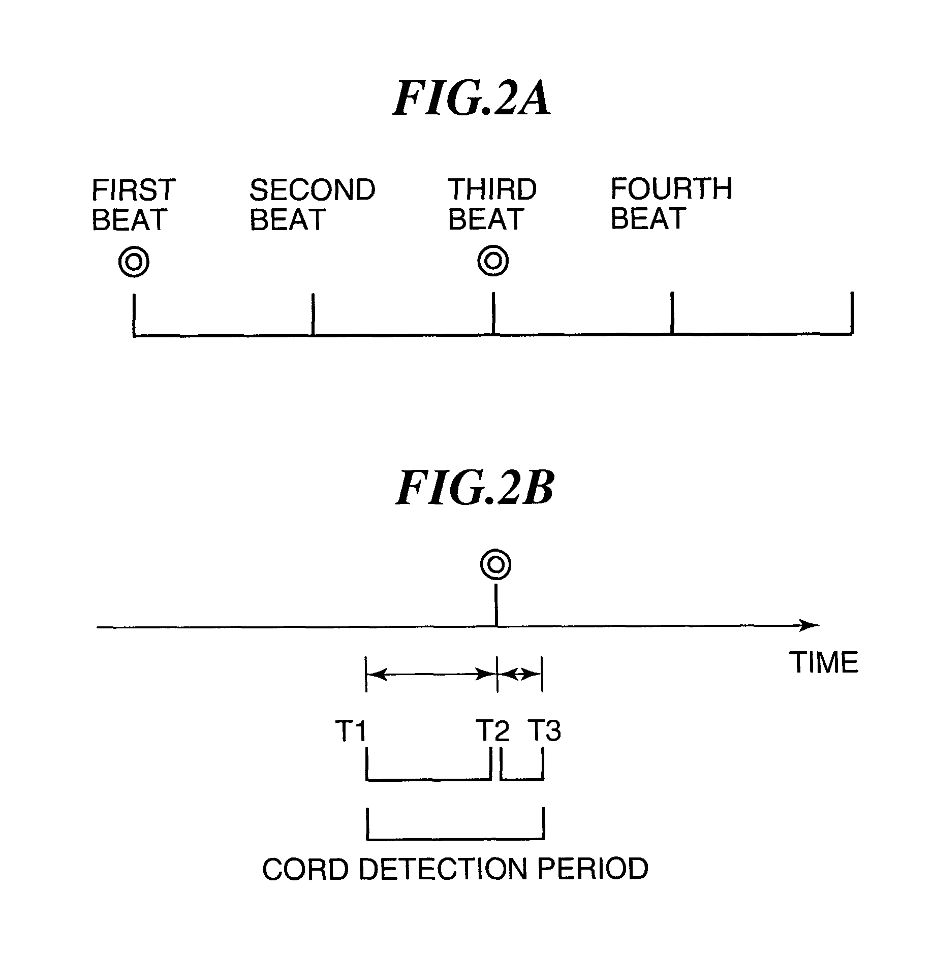 Chord detection apparatus, chord detection method, and program therefor