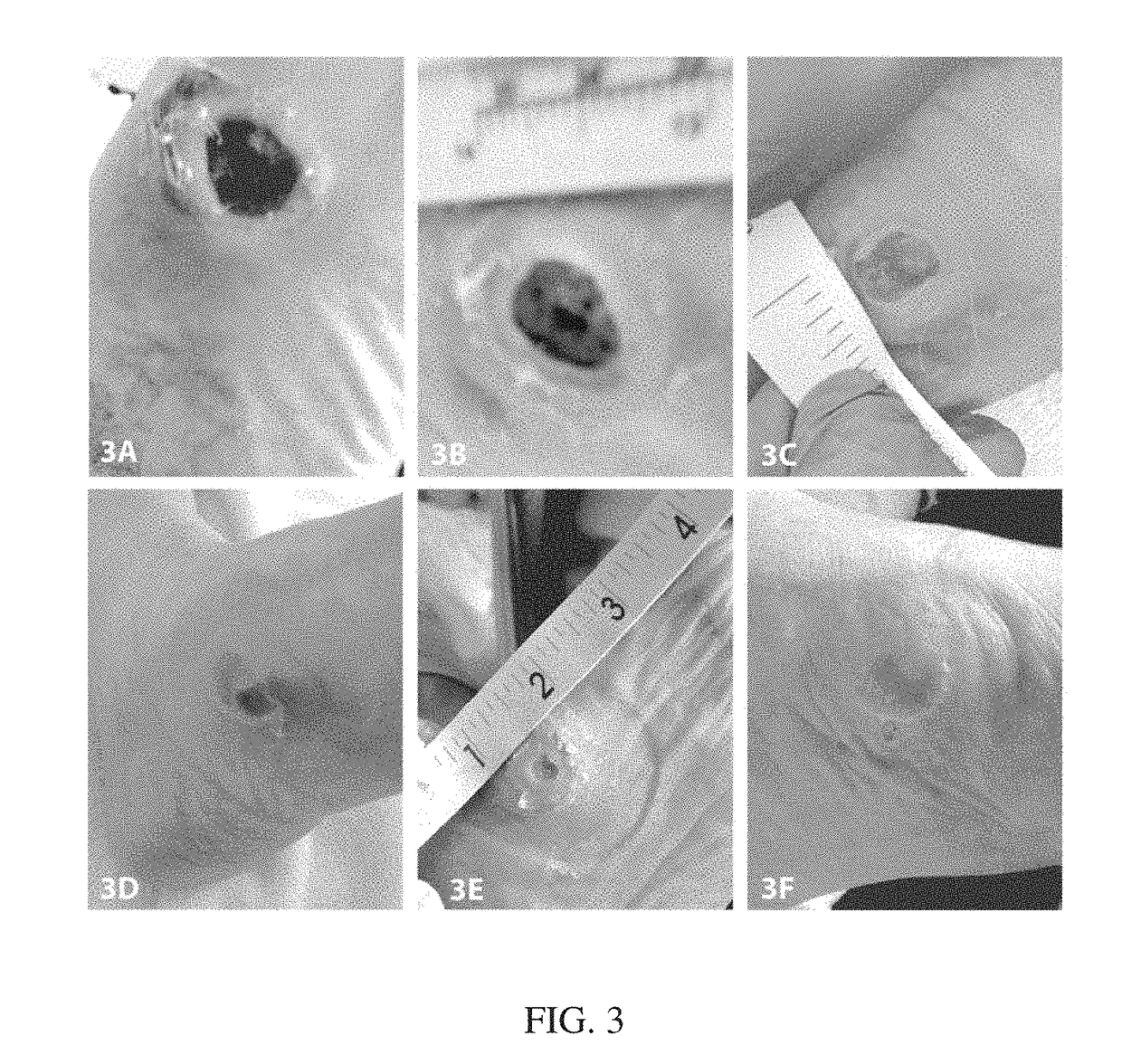 Wound healing compositions involving medicinal honey, mineral ions and methylglyoxal, and methods of use