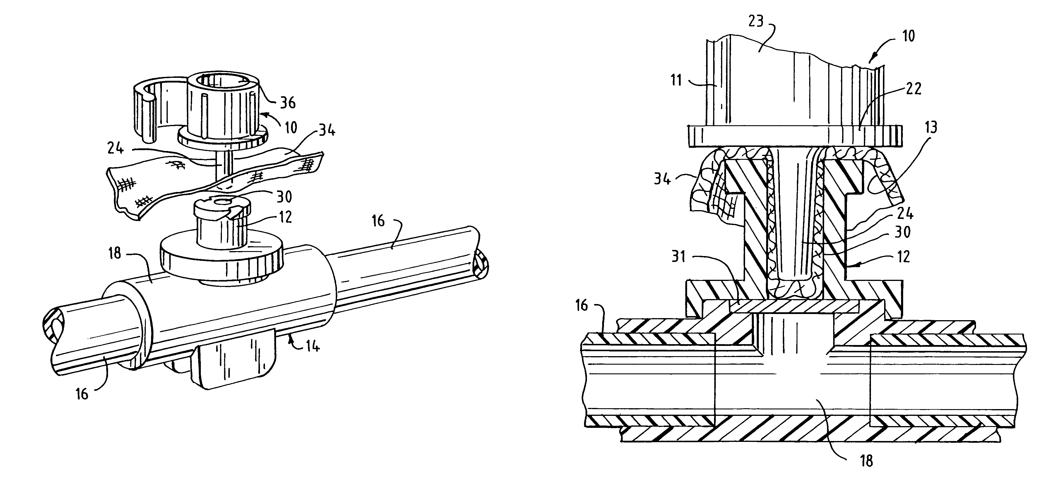 Closure for tubular access port