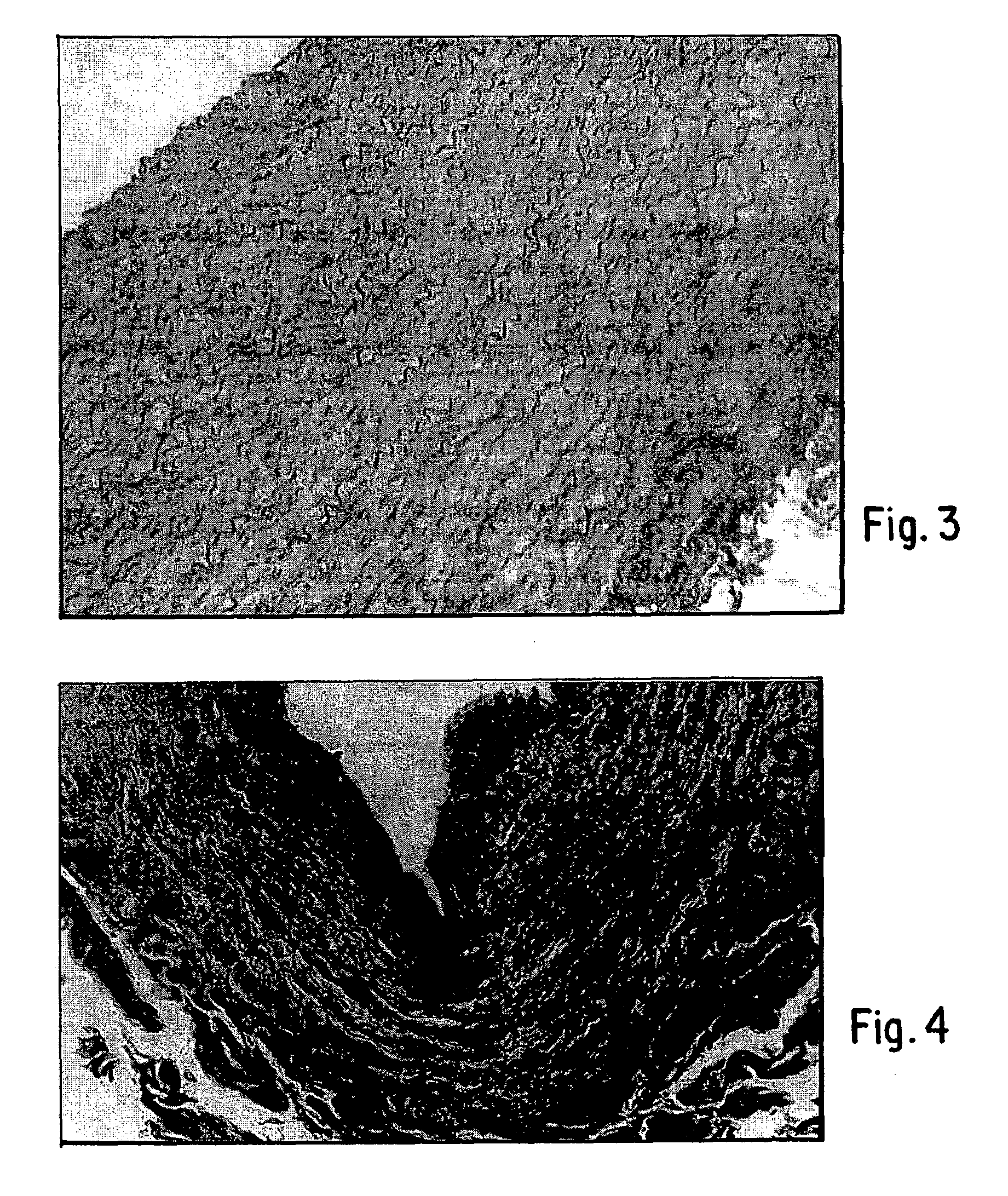 Process for Decellularizing Soft-Tissue Engineered Medical Implants, and Decellularized Soft-Tissue Medical Implants Produced