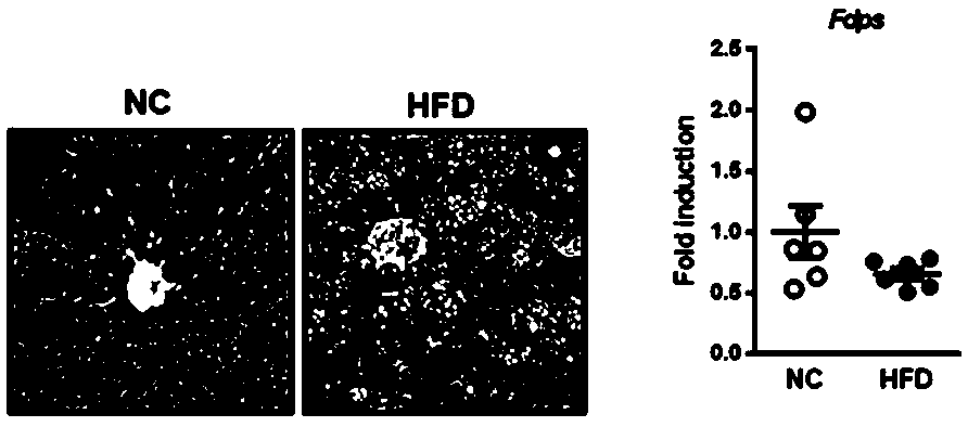 Application of FDPS (farnesyl pyrophosphate synthase) for preparing medicine capable of treating nonalcoholic steatohepatitis