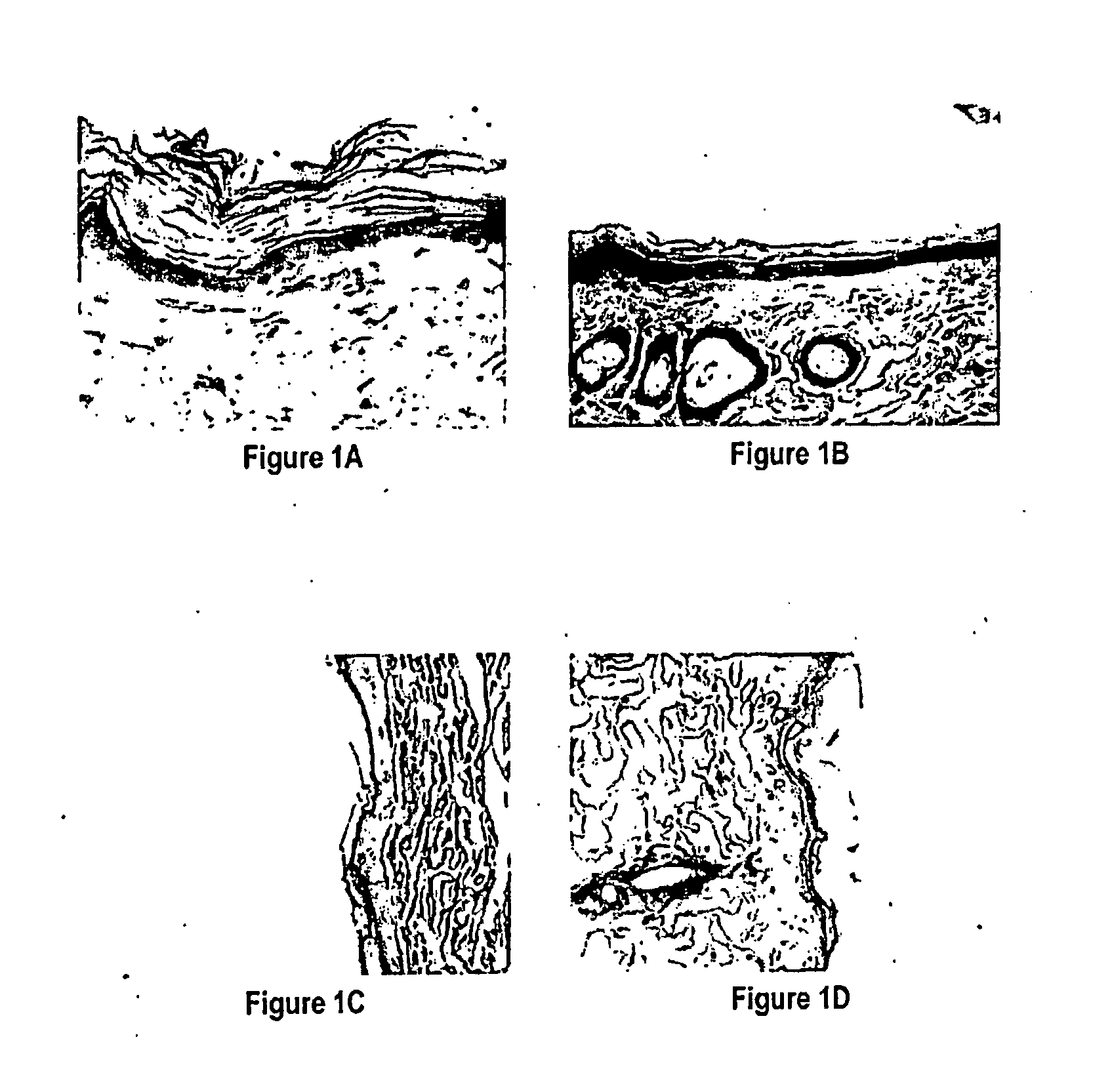 Methods and compositions for bone and cartilage repair