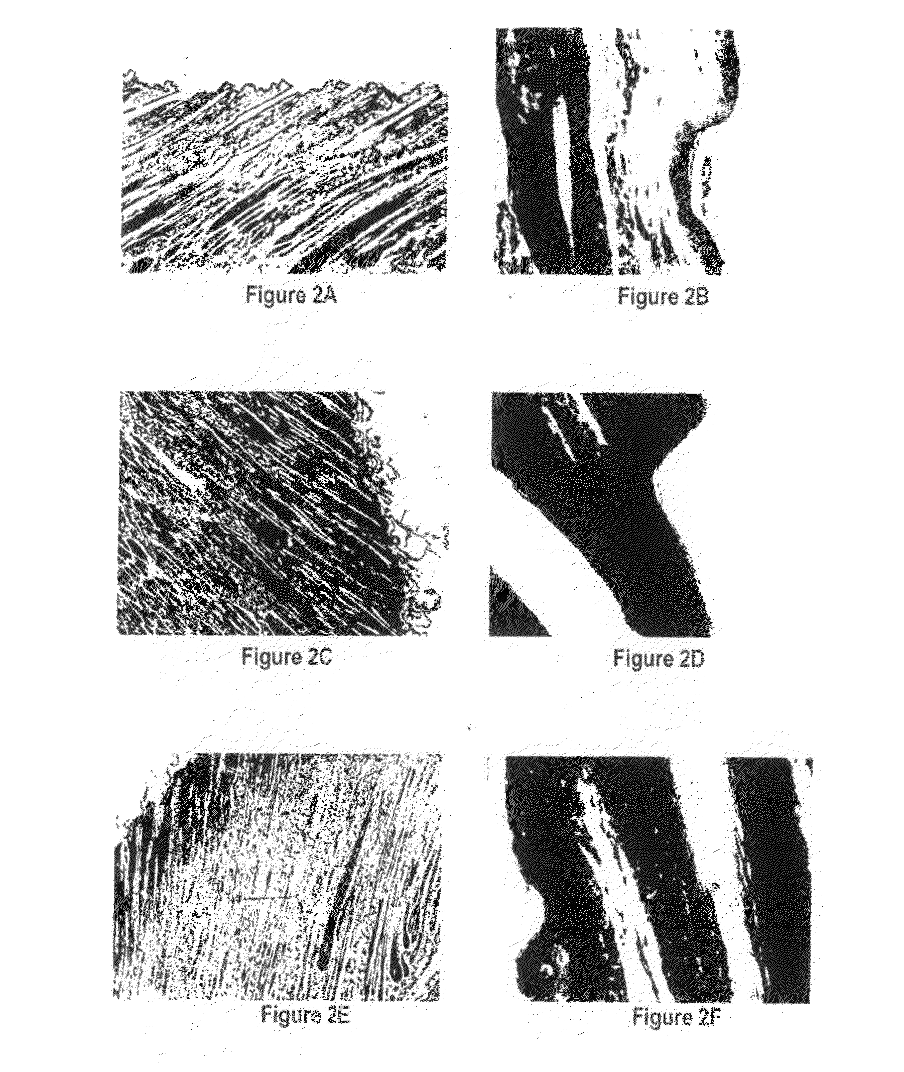 Methods and compositions for bone and cartilage repair