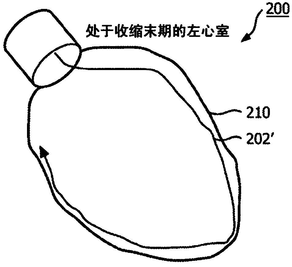 Shape sensing devices for real-time mechanical function assessment of an internal organ