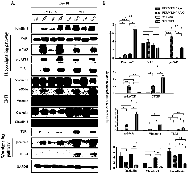 Specific long-acting siRNA and application thereof to treatment of renal fibrosis
