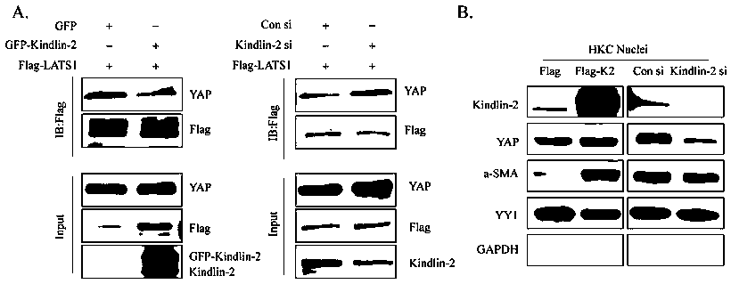 Specific long-acting siRNA and application thereof to treatment of renal fibrosis
