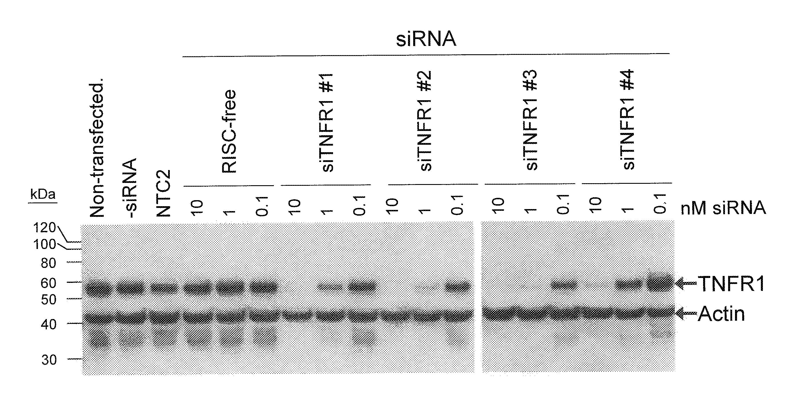 RNAi-RELATED INHIBITION OF TNFalpha SIGNALING PATHWAY FOR TREATMENT OF OCULAR ANGIOGENESIS