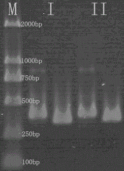 DGGE/TGGE (Denaturing Gradient Gel Electrophoresis/Temperature Gradient Gel Electrophoresis) analysis method of specific 18S rDNA (Deoxyribose Nucleic Acid) fragment without being based on GC clamp strategy