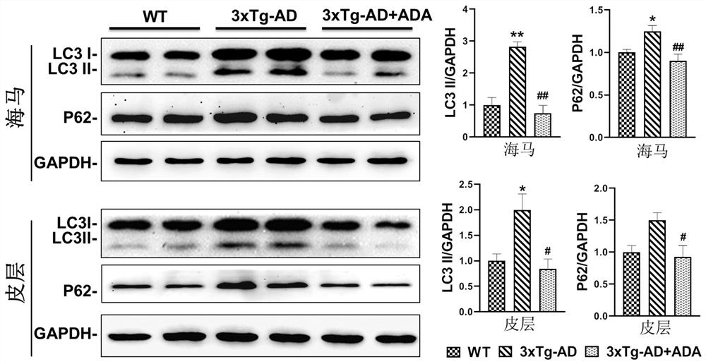 Application of triacetyl andrographolide as medicine for regulating degradation of autophagosome