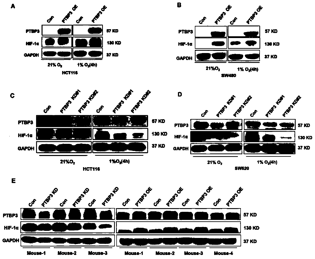 Drug targets for treating colon cancer