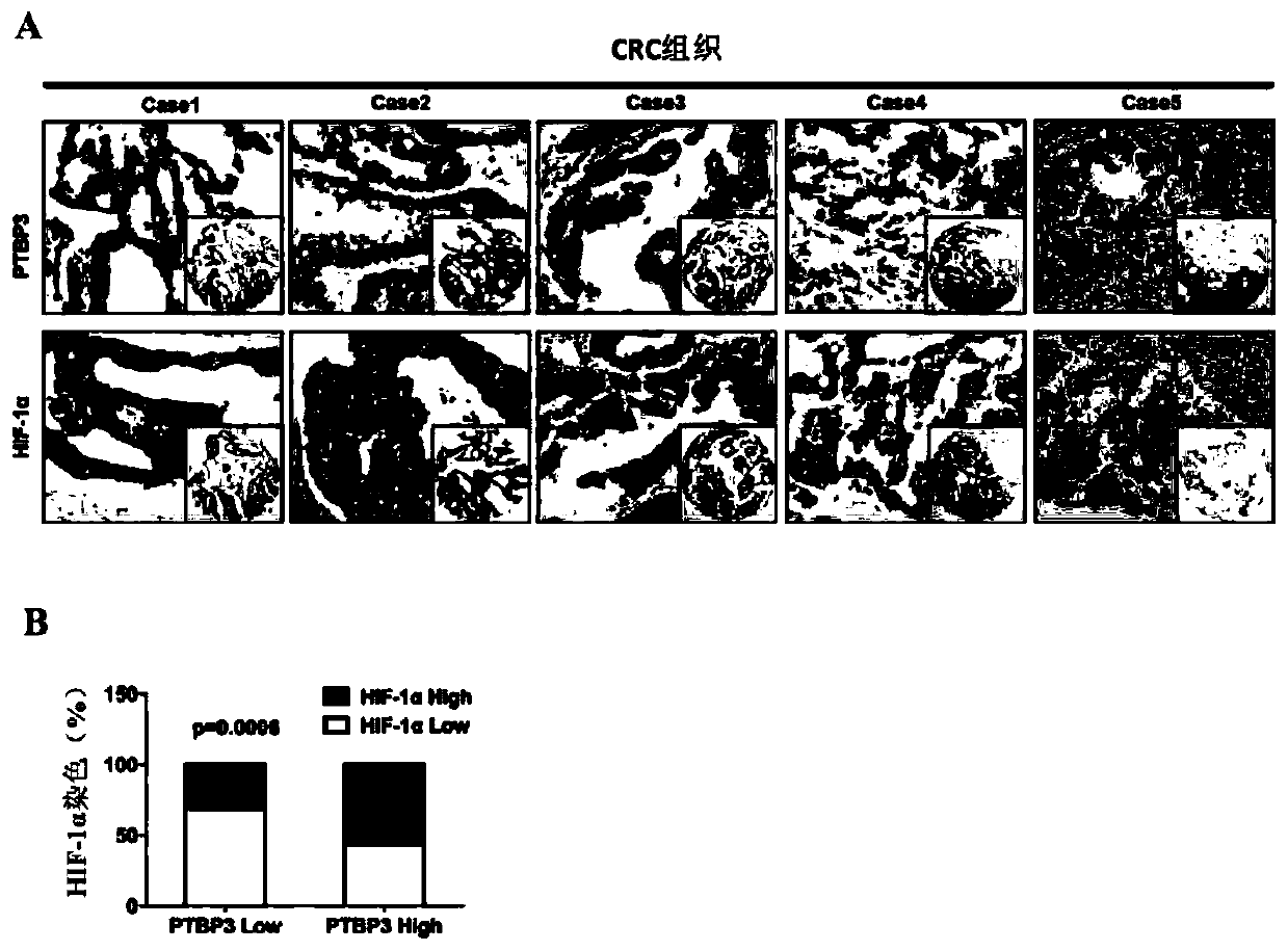 Drug targets for treating colon cancer