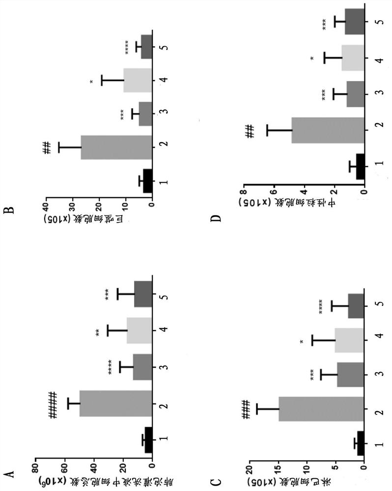 Application of thymosin beta4 in preparation of medicine for treating pulmonary fibrosis complicated with lung cancer disease